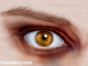 راههای درمان کبودی زیر چشم