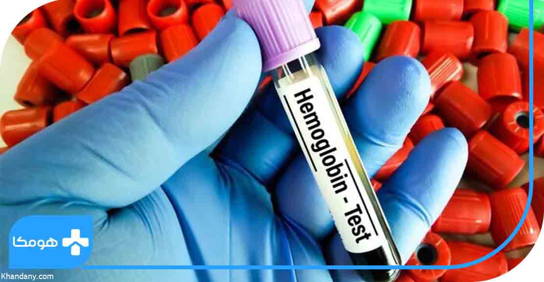 پایین بودن هموگلوبین در آزمایش خون