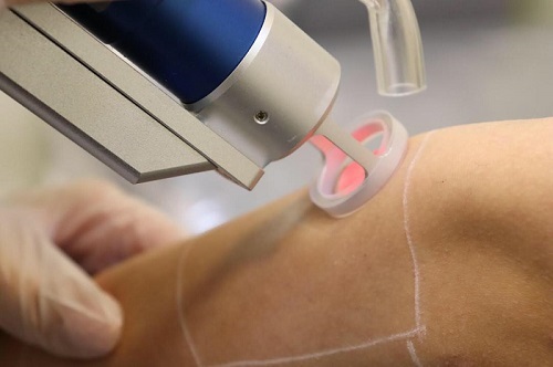 مرکز لیزر اصفهان